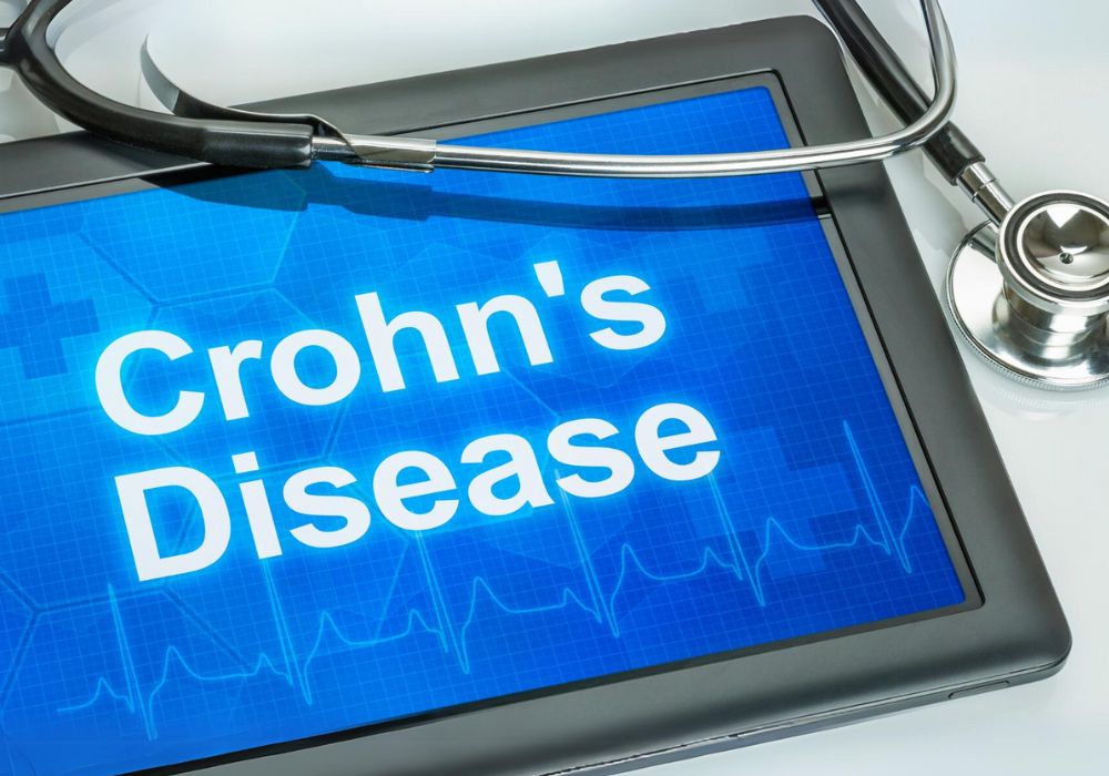Um tablet com uma imagem escrita Crohn`s Disease e um estetoscópio acima.