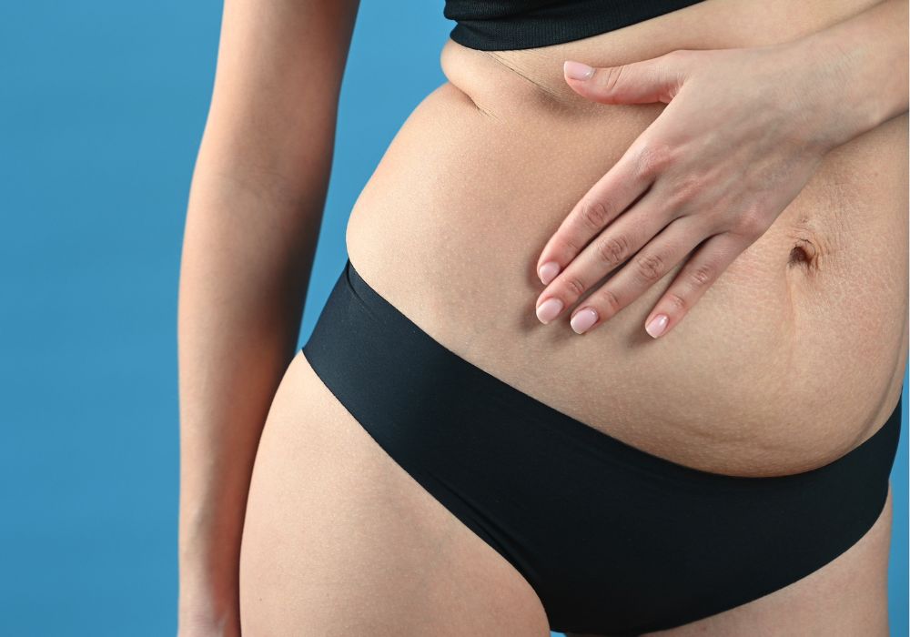 Uma mulher segurando a barriga, que está inchada. Suco para desinchar.