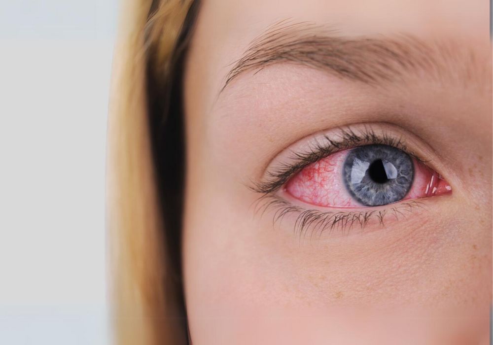 Zoom em um dos olhos azuis de uma mulher .