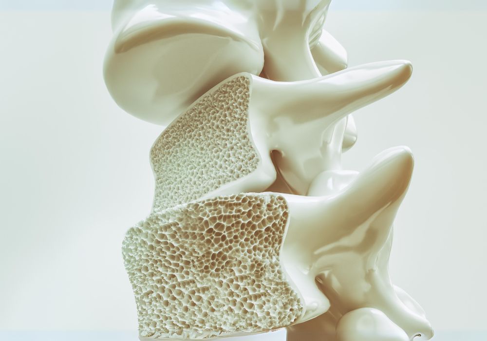 Imagem em 3D de uma parte do osso da coluna cortado ao meio, mostrando a porosidade do osso em decorrência da osteoporose.